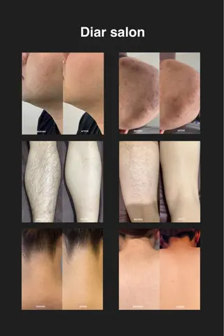 Diar salonのその他イメージ