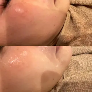 VERY VERY九条店所属・ベリーベリー🌹 九条店のエステ・リラクイメージ