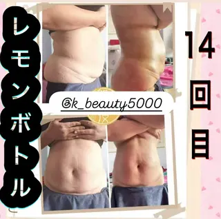 【ハイパーナイフ痩身&小顔コルギ&ハーブピーリング】K-Beauty　東新宿所属・kーbeauty痩身 フェイシャルのエステ・リラクイメージ