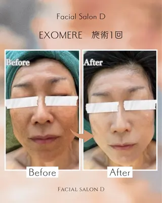 facial salon D 吉沢のエステ・リラクイメージ