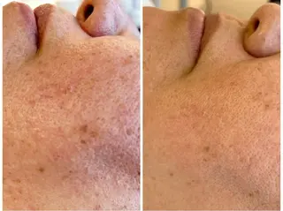 エステサロンMee. 大畑のエステ・リラクイメージ