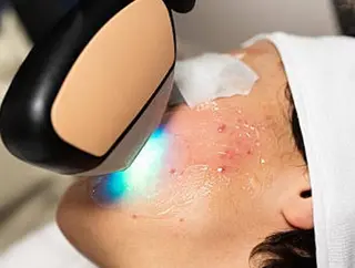 顔脱毛＆毛穴＆ニキビ 優良№1♪ヒロコ♪のエステ・リラクイメージ