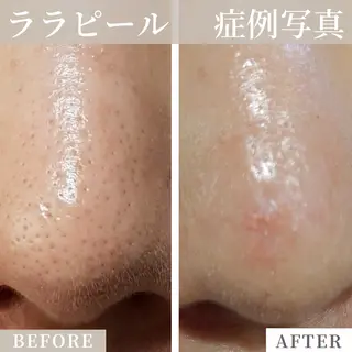 Liam《美肌管理/ 3D小顔/脂肪ケア》のその他イメージ