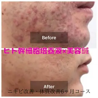 gomi sayakaのエステ・リラクイメージ