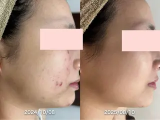 【美肌専門 脱毛】 サロンドジェシカのエステ・リラクイメージ