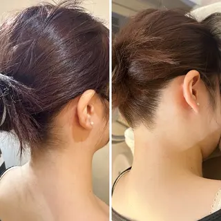 うなじ脱毛/美肌脱毛 LABELのエステ・リラクイメージ