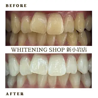 メンズ ホワイトニング ショップ新小岩店のその他イメージ