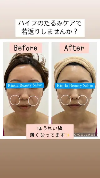 ブライダル痩身×脱毛 尼崎駅前サロンのエステ・リラクイメージ