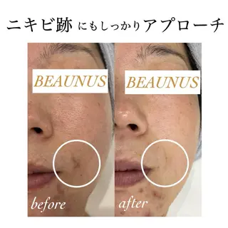 BEAUNUS所属・シミケア専門店 BEAUNUSのエステ・リラクイメージ