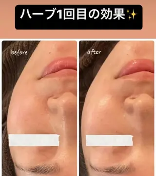 luana beauty所属・kana ハーブピーリング🌿のエステ・リラクイメージ