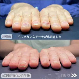 ネイル Nail Salon NANO所属・美爪&巻き爪ケア❤️ ネイルサロンNANOのネイルデザイン