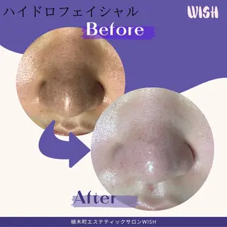 WISH 美肌脱毛のプロ！須藤のエステ・リラクイメージ