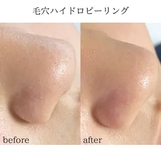 メンズ salonLADYSTYLE所属・稲嶺 美華のエステ・リラクイメージ