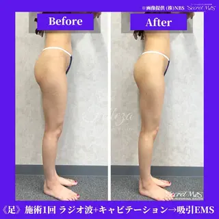 メンズ 有人型セルフサロン 脱毛/痩身/美顔のその他イメージ