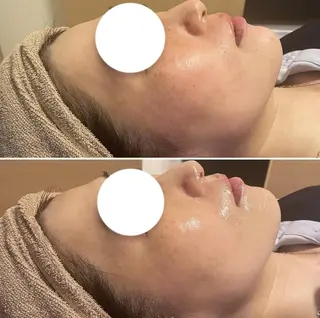 アイブロウ キッズ メンズ Epina 千葉店 【エピナ】のエステ・リラクイメージ