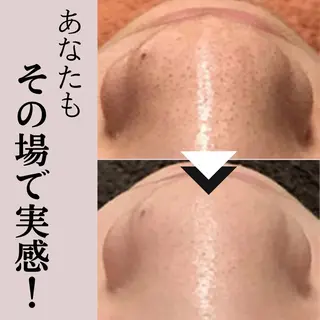 毛穴専門店Bebe 蘭のエステ・リラクイメージ