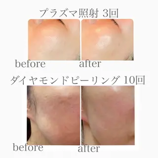 Lily branc 痩身/小顔/肌質改善のエステ・リラクイメージ