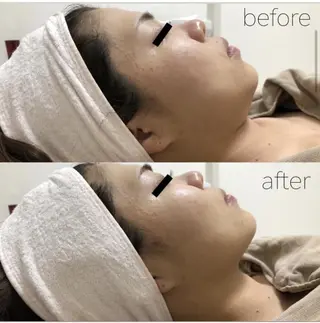 ✨美肌水光✨ アトリエリュバンのエステ・リラクイメージ