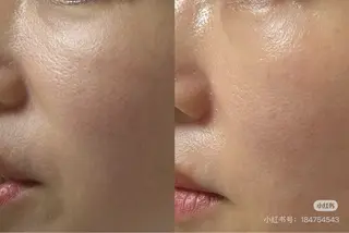 ショート aliaハイフ&水光ジェットサロン所属・aliaハーブ水光店 エステティシャン募集のエステ・リラクイメージ