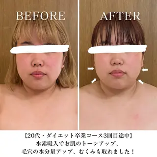 【目黒】本格痩身✴︎ 最新型よもぎ蒸しのエステ・リラクイメージ