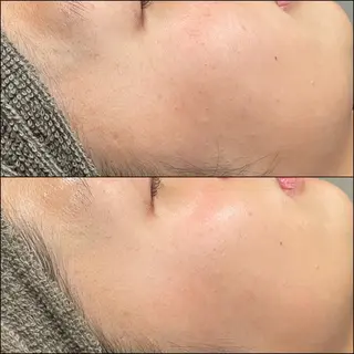 LiZA エステティックサロンのエステ・リラクイメージ