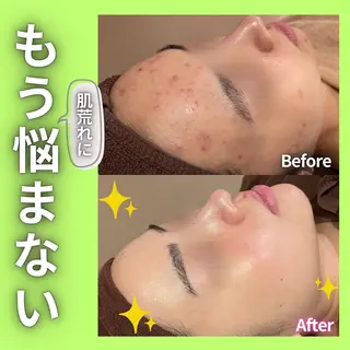 痩身&美肌サロン 遠藤🍊のエステ・リラクイメージ