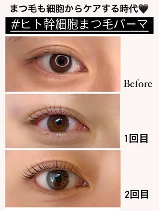 マツエク・マツパ アイラッシュ&フェイシャルサロン ベアトリーチェ所属・医療提携美容サロン Beatriceのエステ・リラクイメージ