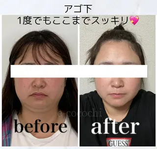 小顔と ヘッドスパのお店のエステ・リラクイメージ