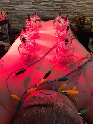 美容鍼灸整体サロンBeauJu所属・小顔矯/美容鍼/鍼灸 BeauJuのその他イメージ