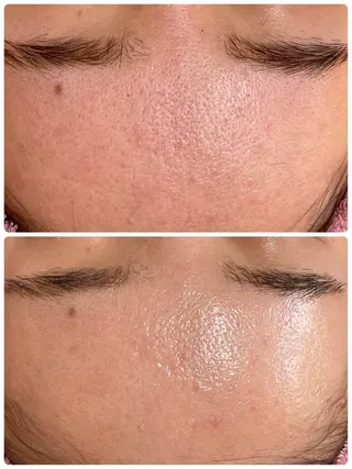 肌質改善専門店/絹々(きぬ)所属・心満たされる ハーブピーリング絹々のエステ・リラクイメージ