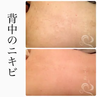 BeSkin藤沢店所属・ニキビ/肌質改善 BeSkin 藤沢店のエステ・リラクイメージ