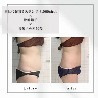 小顔矯正専門店 【RED】池田のエステ・リラクイメージ