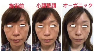 美SORA ～ｳﾞｨｿﾗ～のネイルデザイン