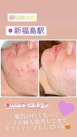 FLEUR大阪・整体 ・ハイフ・痩身・小顔のエステ・リラクイメージ