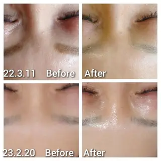 Beauty Salon Luana所属・Luanaまつパ脱毛 ハーブピーリング眉毛のマツエク・マツパデザイン