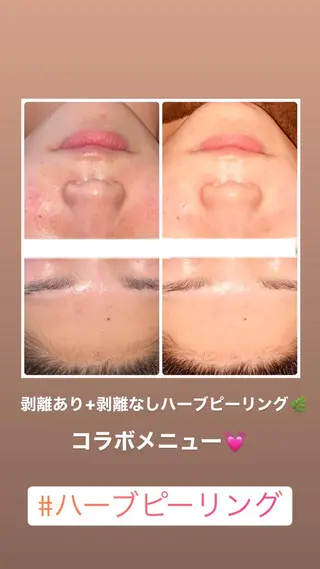 FLEUR大阪・整体 ・ハイフ・痩身・小顔のエステ・リラクイメージ