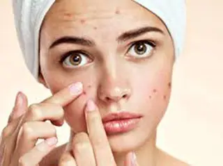 ニキビ、痩身、脱毛、 サクラチャンスパのエステ・リラクイメージ