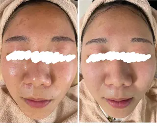 ロング カラー パーマ ヘアアレンジ メンズ キッズ ネイル マツエク・マツパ アイブロウ ニキビ&跡改善サロン オーナー光木のエステ・リラクイメージ