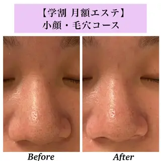 Bellesthe (ベルエステ)のエステ・リラクイメージ