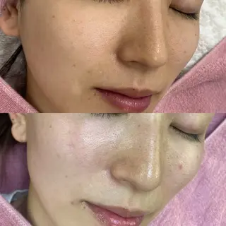 siro スタッフのエステ・リラクイメージ