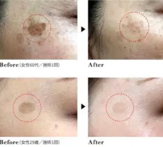 BestBelleꕤ 大阪福島/肌質改善のエステ・リラクイメージ