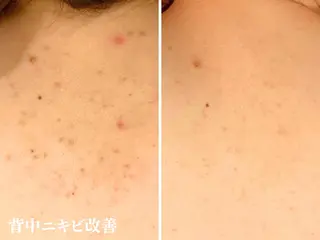 肌弱くてもOK！敏感 肌さんのためのサロンのエステ・リラクイメージ