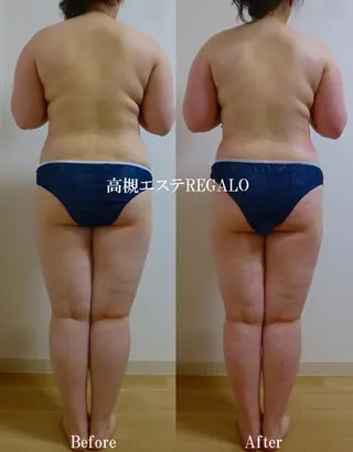 REGALO所属・矢野 さやかのエステ・リラクイメージ