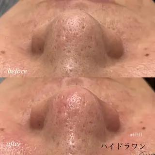 マツエク・マツパ omii salon 草津店:yurinaの眉毛・アイブロウイメージ