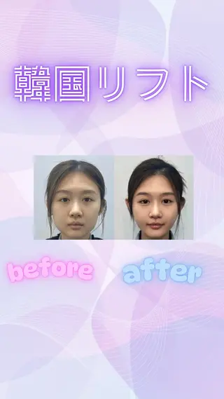 マツエク・マツパ 愛維美水光美肌専門店所属・愛維美水光美肌専門店 メンズレディースokのエステ・リラクイメージ