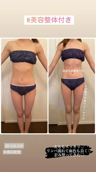 FLEUR大阪・整体 ・ハイフ・痩身・小顔のエステ・リラクイメージ