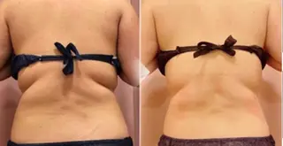 salon de MOREのエステ・リラクイメージ