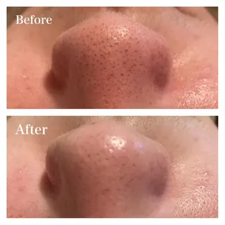 B&H所属・頭痛•肩こり専門/ 眉サロンB&H心斎橋のエステ・リラクイメージ