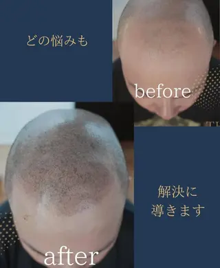 メンズ W eye+東口店/ SCALP INKのマツエク・マツパデザイン