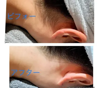 脱毛フェイシャル痩身 エリア最安👑永野舞のエステ・リラクイメージ